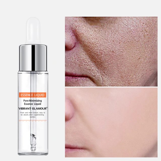 Pore minimizing essence liquid