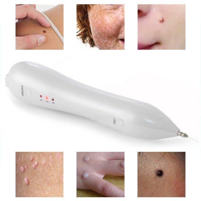 Skin Tag And Mole Remover